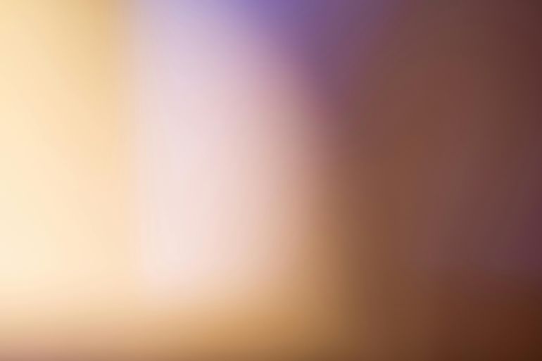 10.02 Супервізія